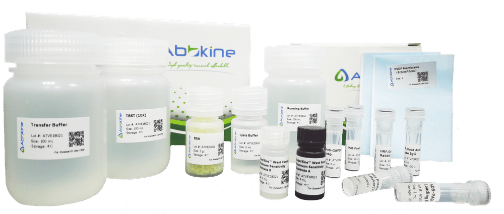 WB专题|通用型免疫印迹（WB）工具箱