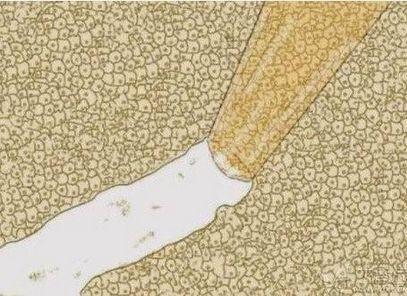 你绝对不容错过的transwell迁移/侵袭实验