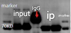 大话IP中的IgG阴性对照