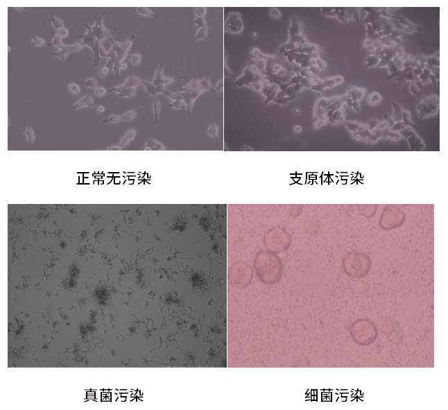 【新品解读】细胞培养如何避坑？大神带你玩转细胞实验