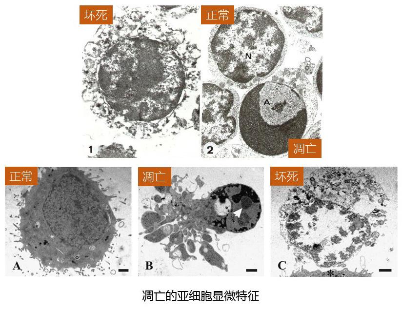 细胞死亡知多少？
