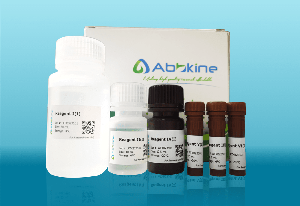 一篇文章了解生化试剂盒和ELISA试剂盒差异！