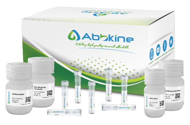 IP实验的首选---磁珠