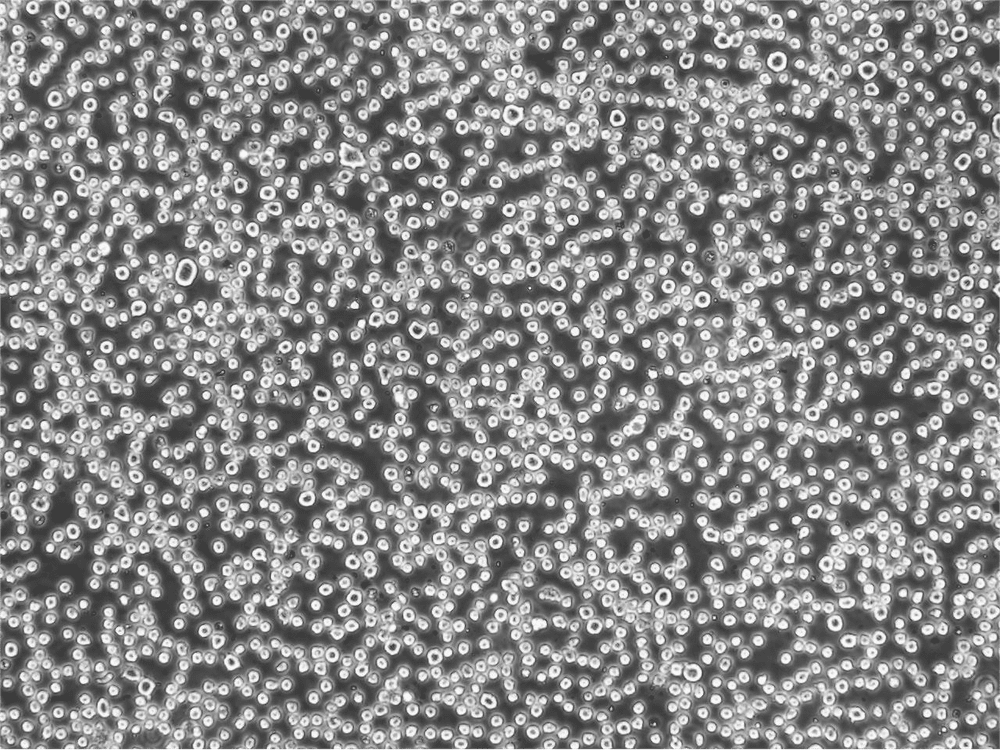 干货|THP-1分化成巨噬细胞诱导攻略