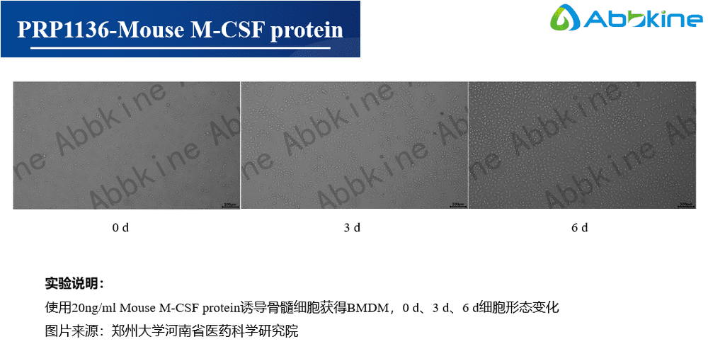 PRP1136-Mouse M-CSF protein（内含细胞因子文献奖励申请通道）