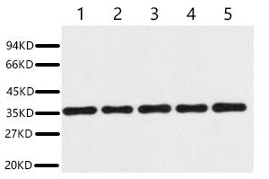GAPDH兔多克隆抗体