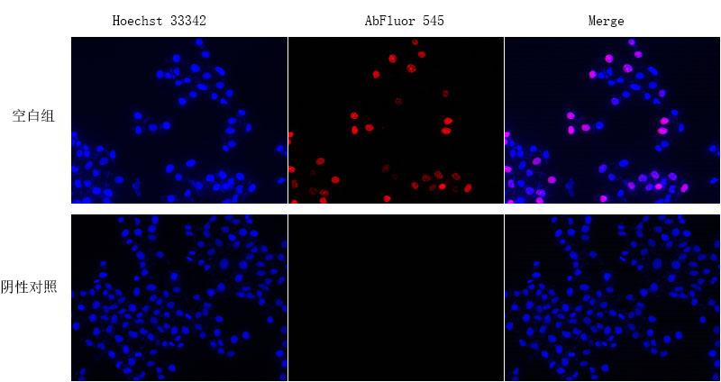 EdU法细胞增殖成像分析试剂盒(橙色荧光)