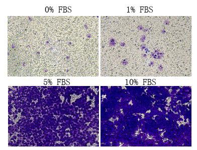 细胞侵袭分析试剂盒(24孔板,8μM)