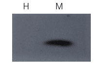 总膜蛋白提取试剂盒-ExKine™