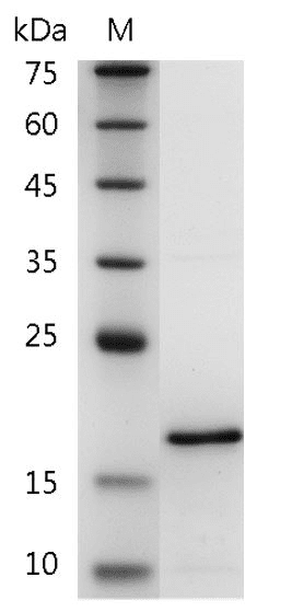 重组人成纤维细胞生长因子6,His-标签(无动物源)(FGF-6)
