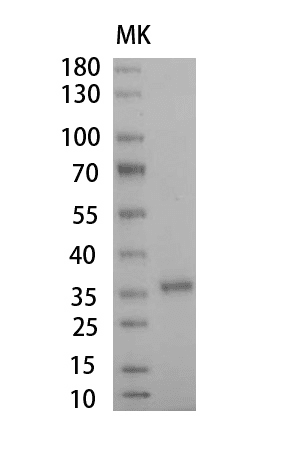 重组人触珠蛋白,His-标签(Haptoglobin )