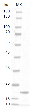 重组大鼠粒细胞巨噬细胞集落刺激因子,His-标签(GM-CSF)