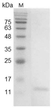 重组小鼠白介素9,His-标签(无动物源)(IL-9)