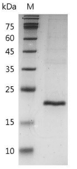 重组小鼠肿瘤坏死因子-β,His-标签(无动物源)(TNF-β)
