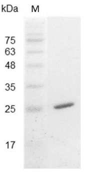 重组小鼠白介素-30,His-标签(无动物源)(IL-30)
