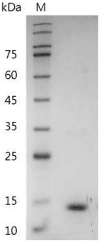 重组小鼠白介素-31,His-标签(无动物源)(IL-31)