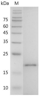 重组小鼠白介素-38,His-标签(无动物源)(IL-38)