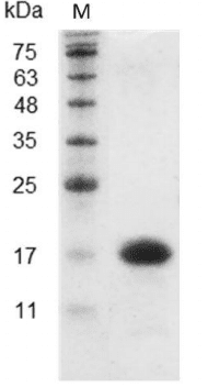 重组小鼠白介素-16,His-标签(无动物源)(IL-16)