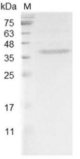 重组小鼠肝素结合生长因子,His-标签(无动物源)(HDGF)