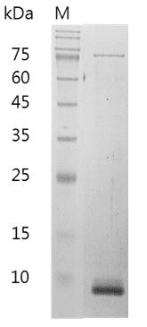 重组小鼠CXC趋化因子配体10,His-标签(无动物源)(CXCL10)