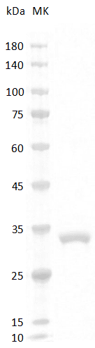 重组小鼠脂联素蛋白,His-标签(Adiponectin)