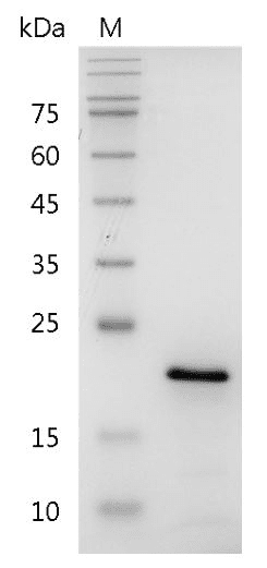 重组人成纤维细胞生长因子10,His-标签(无动物源)(FGF-10)