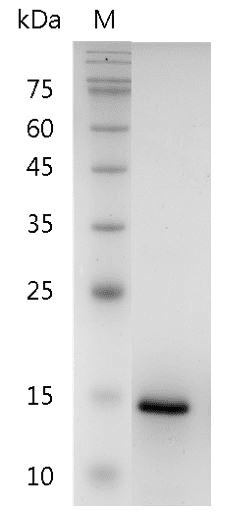 重组人CXC趋化因子配体9,His-标签(无动物源)(CXCL9)