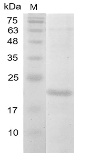 重组人白介素-38,His-标签(无动物源)(IL-38)