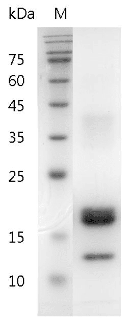 重组人巨噬细胞集落刺激因子(M-CSF),His-标签(无动物源)(M-CSF)