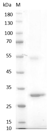 重组人Noggin蛋白,His-标签(Noggin)