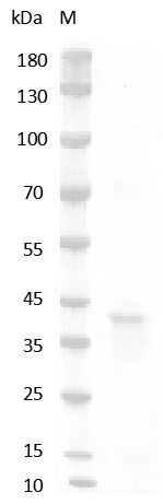 重组人RSPO1/R-spondin-1 蛋白(RSPO1/R-spondin-1)